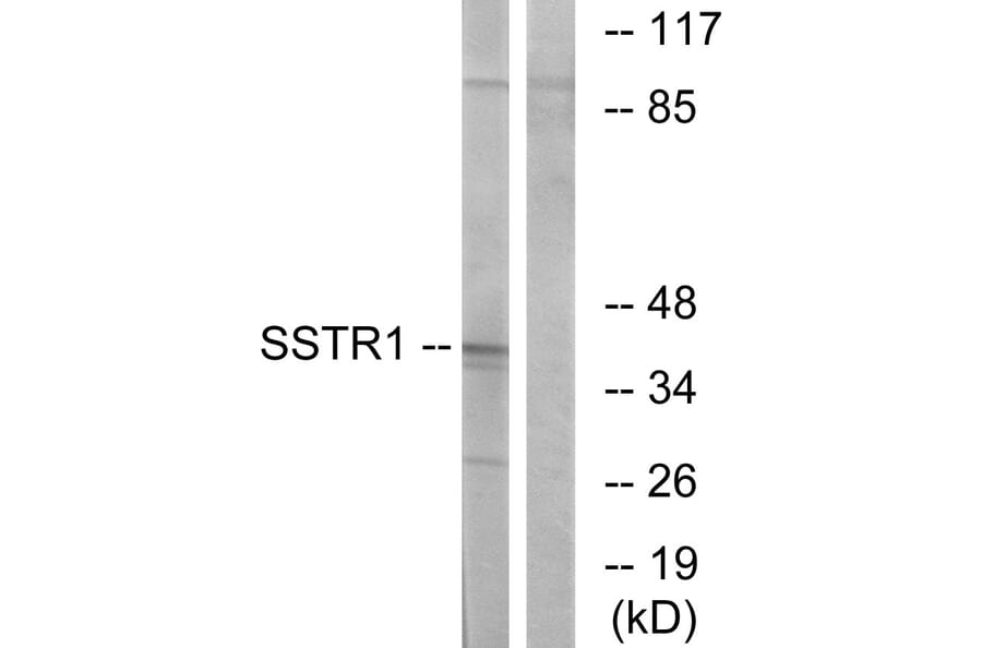 Western Blot - Anti-SSTR1 Antibody (G744) - Antibodies.com