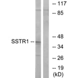 Western Blot - Anti-SSTR1 Antibody (G744) - Antibodies.com