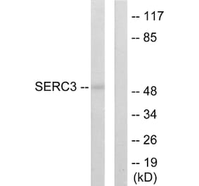Western Blot - Anti-SERC3 Antibody (C10988) - Antibodies.com