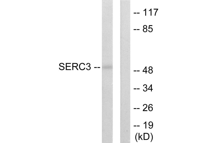 Western Blot - Anti-SERC3 Antibody (C10988) - Antibodies.com