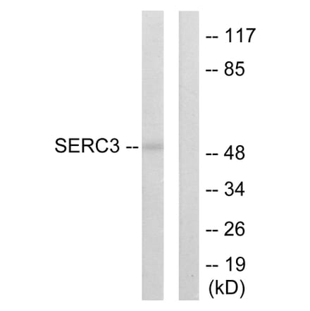Western Blot - Anti-SERC3 Antibody (C10988) - Antibodies.com