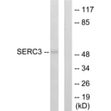 Western Blot - Anti-SERC3 Antibody (C10988) - Antibodies.com