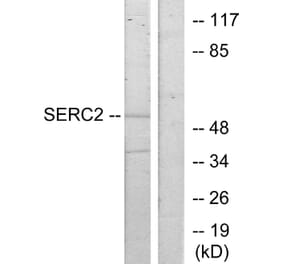 Western Blot - Anti-SERC2 Antibody (C11547) - Antibodies.com