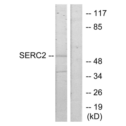 Western Blot - Anti-SERC2 Antibody (C11547) - Antibodies.com