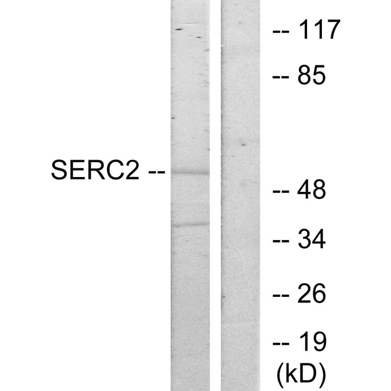 Western Blot - Anti-SERC2 Antibody (C11547) - Antibodies.com