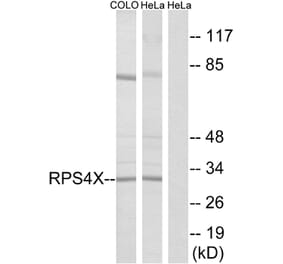 Western Blot - Anti-RPS4X Antibody (C14121) - Antibodies.com