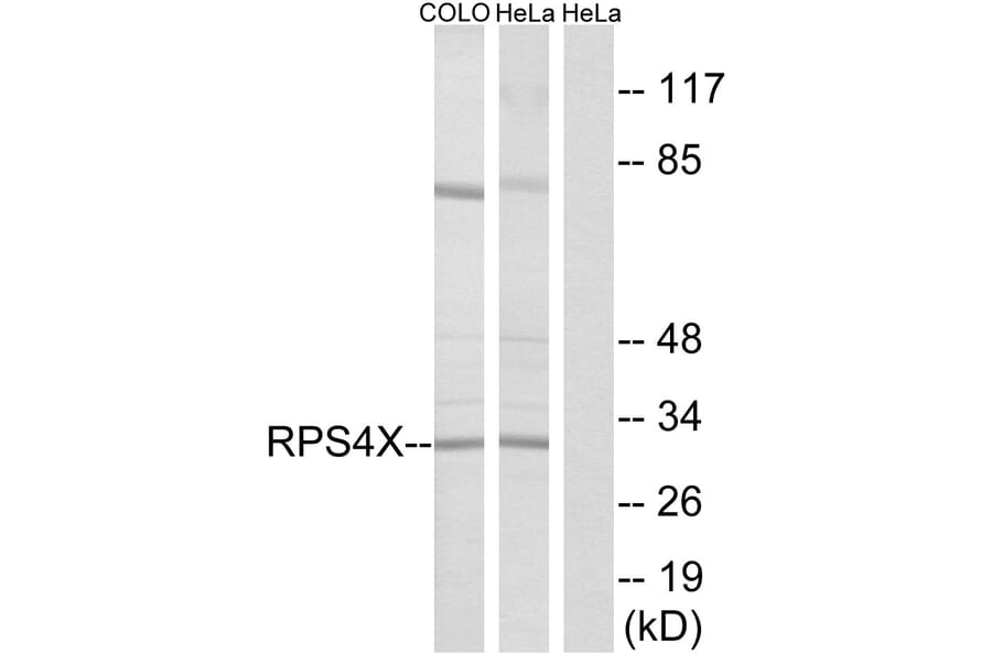 Western Blot - Anti-RPS4X Antibody (C14121) - Antibodies.com