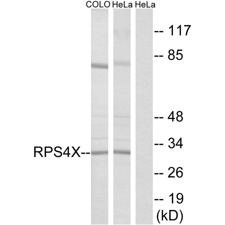 Western Blot - Anti-RPS4X Antibody (C14121) - Antibodies.com