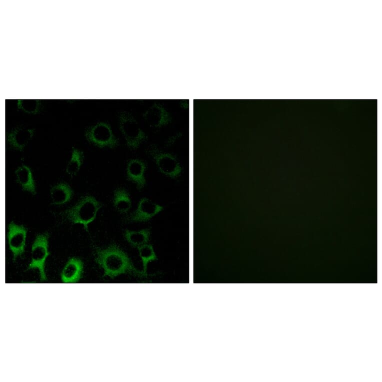 Immunofluorescence - Anti-RPS4X Antibody (C14121) - Antibodies.com