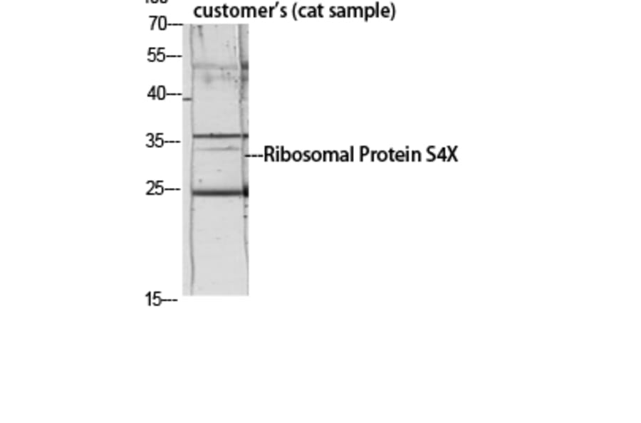 Western Blot - Anti-RPS4X Antibody (C14121) - Antibodies.com