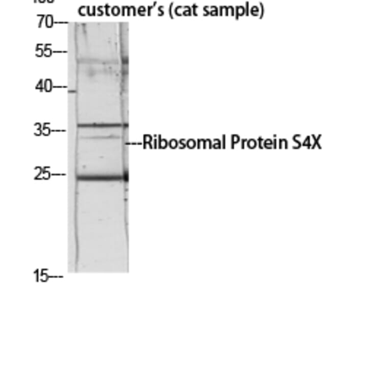 Western Blot - Anti-RPS4X Antibody (C14121) - Antibodies.com