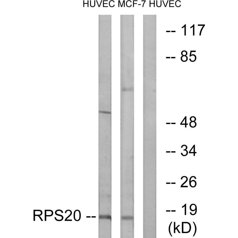 Western Blot - Anti-RPS20 Antibody (C14106) - Antibodies.com
