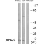 Western Blot - Anti-RPS20 Antibody (C14106) - Antibodies.com