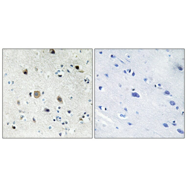 Immunohistochemistry - Anti-RPS20 Antibody (C14106) - Antibodies.com