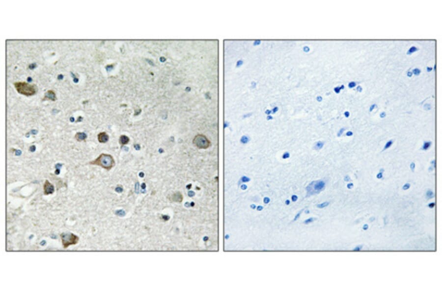 Immunohistochemistry - Anti-RPS12 Antibody (C14095) - Antibodies.com