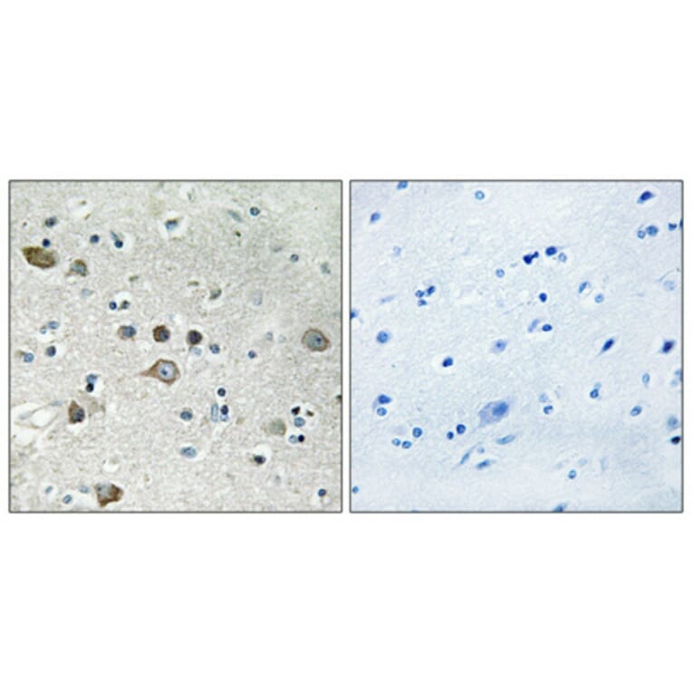 Immunohistochemistry - Anti-RPS12 Antibody (C14095) - Antibodies.com