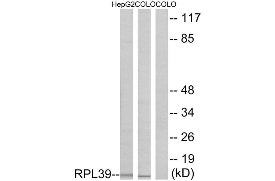 Western Blot - Anti-RPL39 Antibody (C14181) - Antibodies.com
