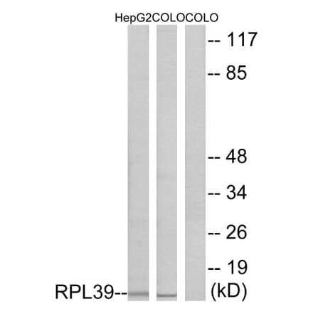 Western Blot - Anti-RPL39 Antibody (C14181) - Antibodies.com