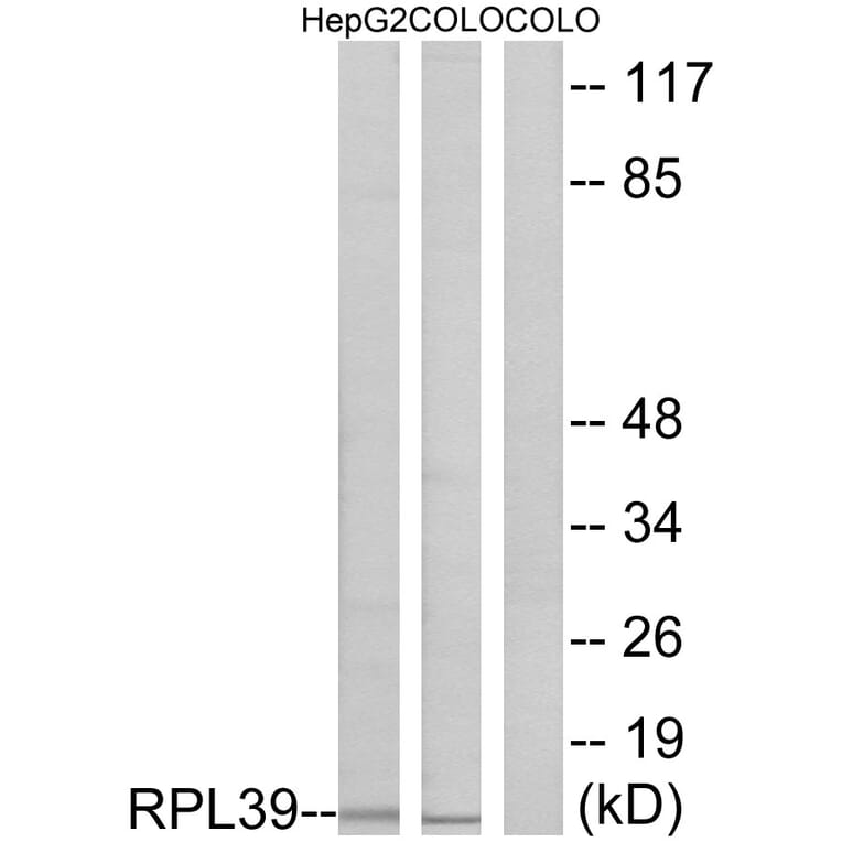 Western Blot - Anti-RPL39 Antibody (C14181) - Antibodies.com