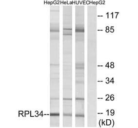 Western Blot - Anti-RPL34 Antibody (C14172) - Antibodies.com