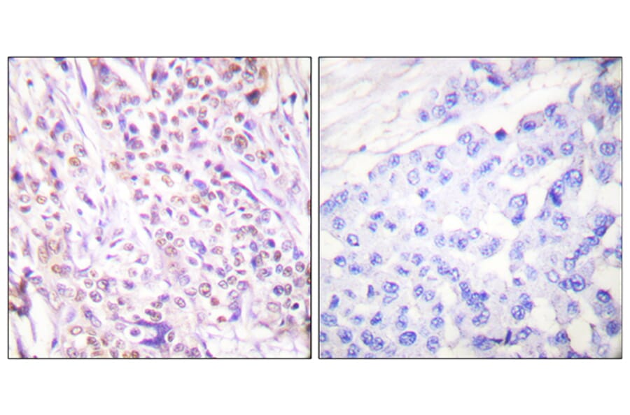 Immunohistochemistry - Anti-RAD17 Antibody (B0085) - Antibodies.com