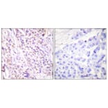 Immunohistochemistry - Anti-RAD17 Antibody (B0085) - Antibodies.com