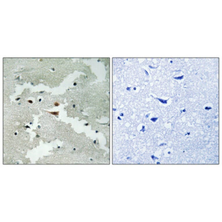 Immunohistochemistry - Anti-PDCD4 Antibody (B1175) - Antibodies.com