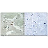 Immunohistochemistry - Anti-PDCD4 Antibody (B1175) - Antibodies.com