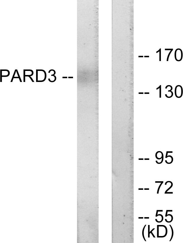 Western blot analysis of lysates from COLO205 cells using Anti-PARD3 Antibody. The right hand lane represents a negative control, where the antibody is blocked by the immunising peptide.