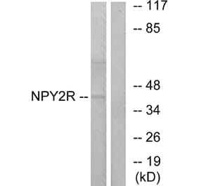 Western Blot - Anti-NPY2R Antibody (G410) - Antibodies.com