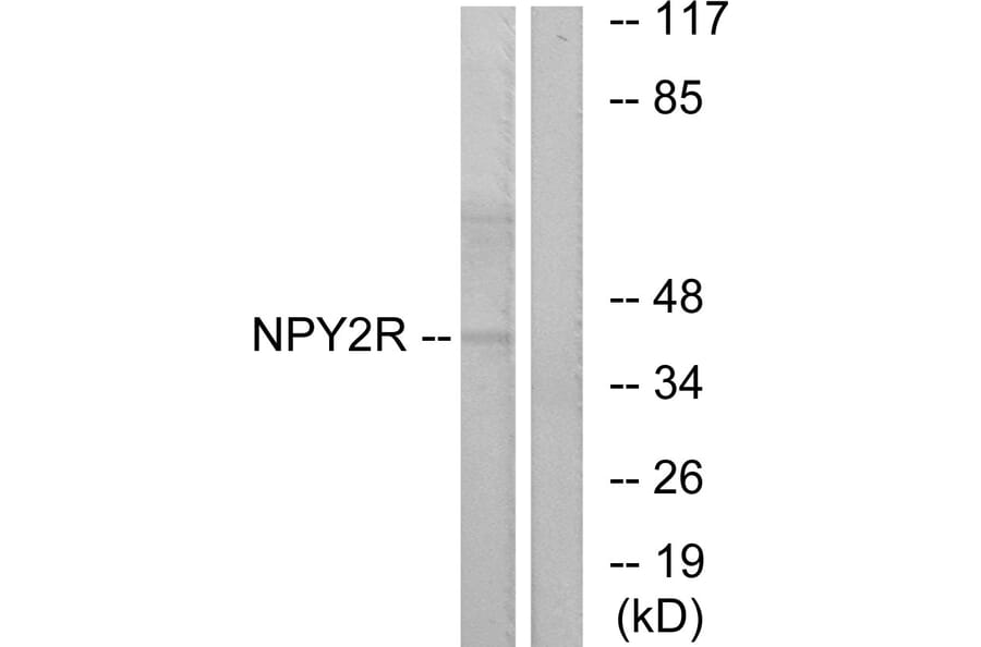 Western Blot - Anti-NPY2R Antibody (G410) - Antibodies.com