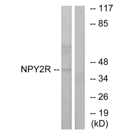 Western Blot - Anti-NPY2R Antibody (G410) - Antibodies.com
