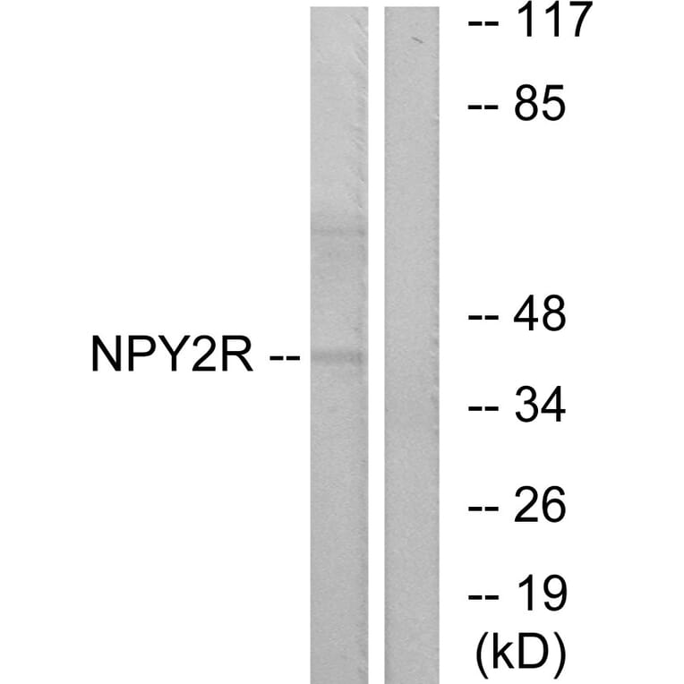 Western Blot - Anti-NPY2R Antibody (G410) - Antibodies.com