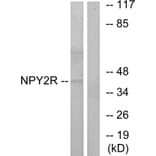 Western Blot - Anti-NPY2R Antibody (G410) - Antibodies.com