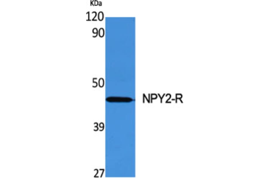 Western Blot - Anti-NPY2R Antibody (G410) - Antibodies.com