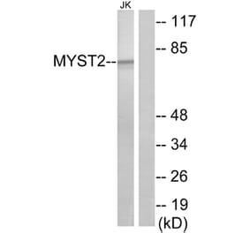 Western Blot - Anti-MYST2 Antibody (C10221) - Antibodies.com