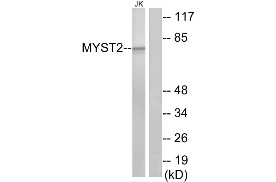 Western Blot - Anti-MYST2 Antibody (C10221) - Antibodies.com