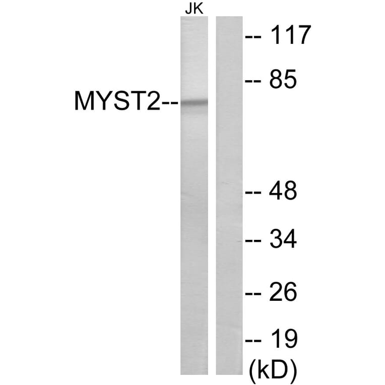Western Blot - Anti-MYST2 Antibody (C10221) - Antibodies.com