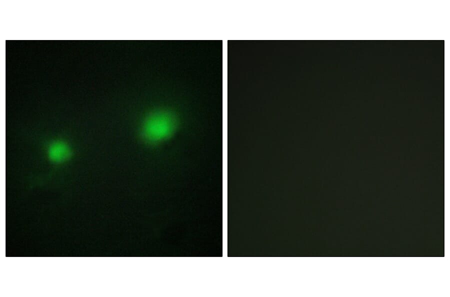 Immunofluorescence - Anti-MYST2 Antibody (C10221) - Antibodies.com