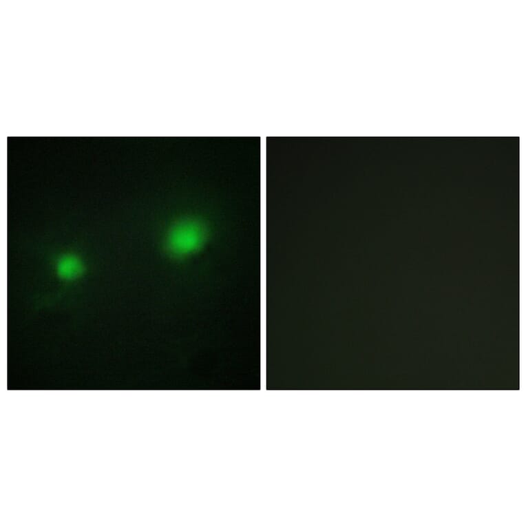 Immunofluorescence - Anti-MYST2 Antibody (C10221) - Antibodies.com