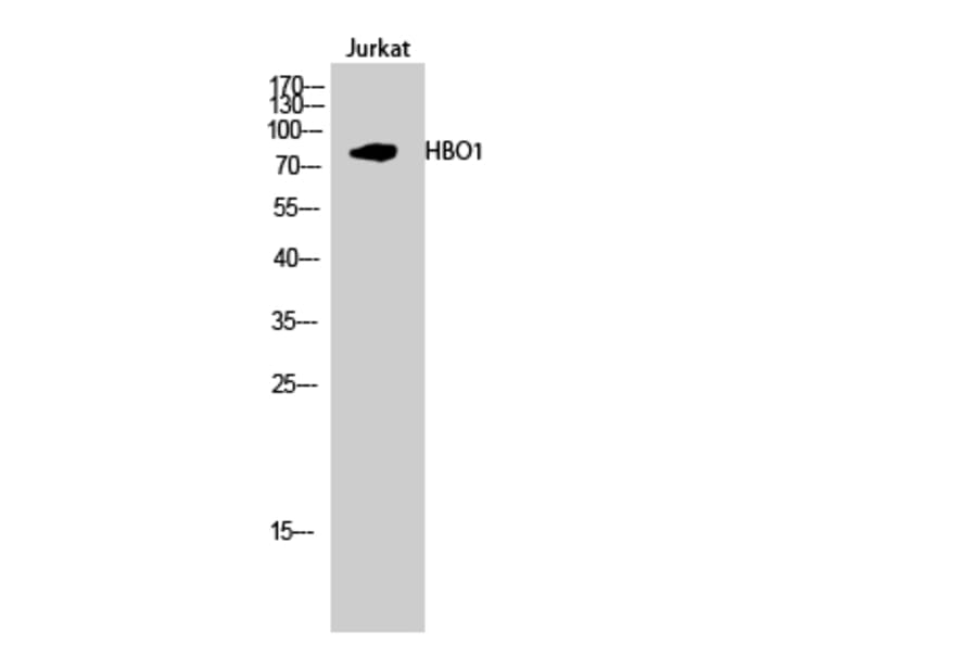 Western Blot - Anti-MYST2 Antibody (C10221) - Antibodies.com