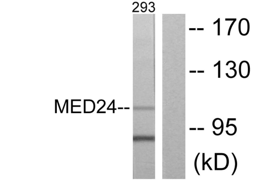 Western Blot - Anti-MED24 Antibody (C10176) - Antibodies.com