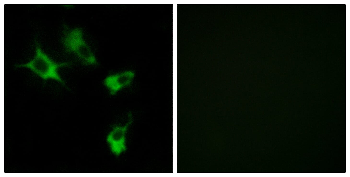 Immunofluorescence analysis of COS7 cells using Anti-MAST4 Antibody. The right hand panel represents a negative control, where the antibody was pre-incubated with the immunising peptide.