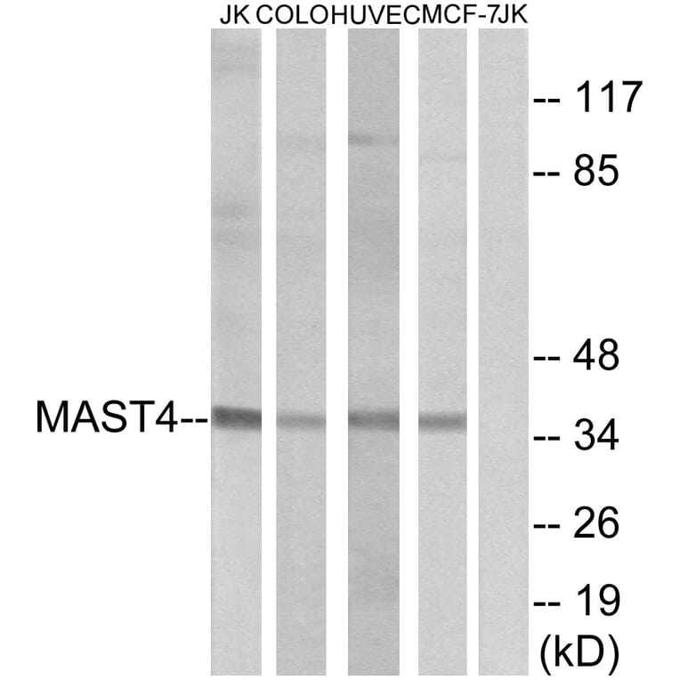 Western Blot - Anti-MAST4 Antibody (C10066) - Antibodies.com