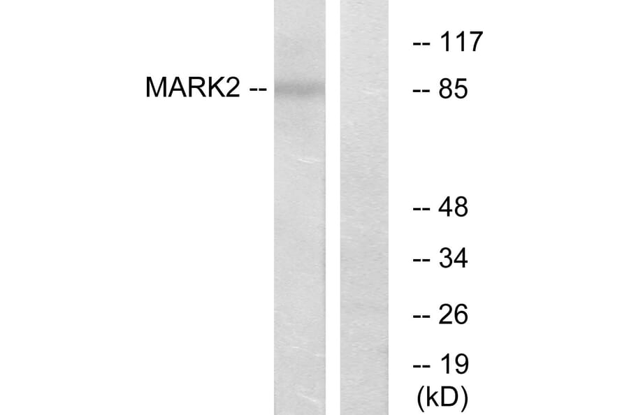 Western Blot - Anti-MARK2 Antibody (C11249) - Antibodies.com
