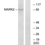 Western Blot - Anti-MARK2 Antibody (C11249) - Antibodies.com