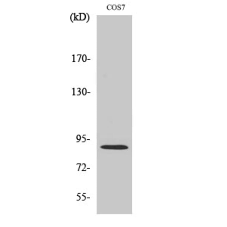 Western Blot - Anti-MARK2 Antibody (C11249) - Antibodies.com