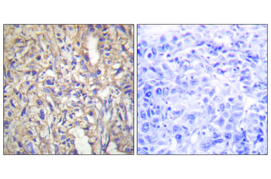 Immunohistochemistry - Anti-LAMB1 Antibody (C13069) - Antibodies.com