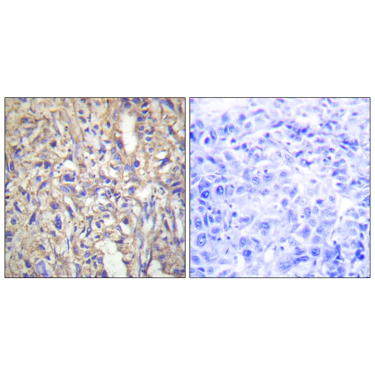 Immunohistochemistry - Anti-LAMB1 Antibody (C13069) - Antibodies.com