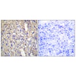 Immunohistochemistry - Anti-LAMB1 Antibody (C13069) - Antibodies.com